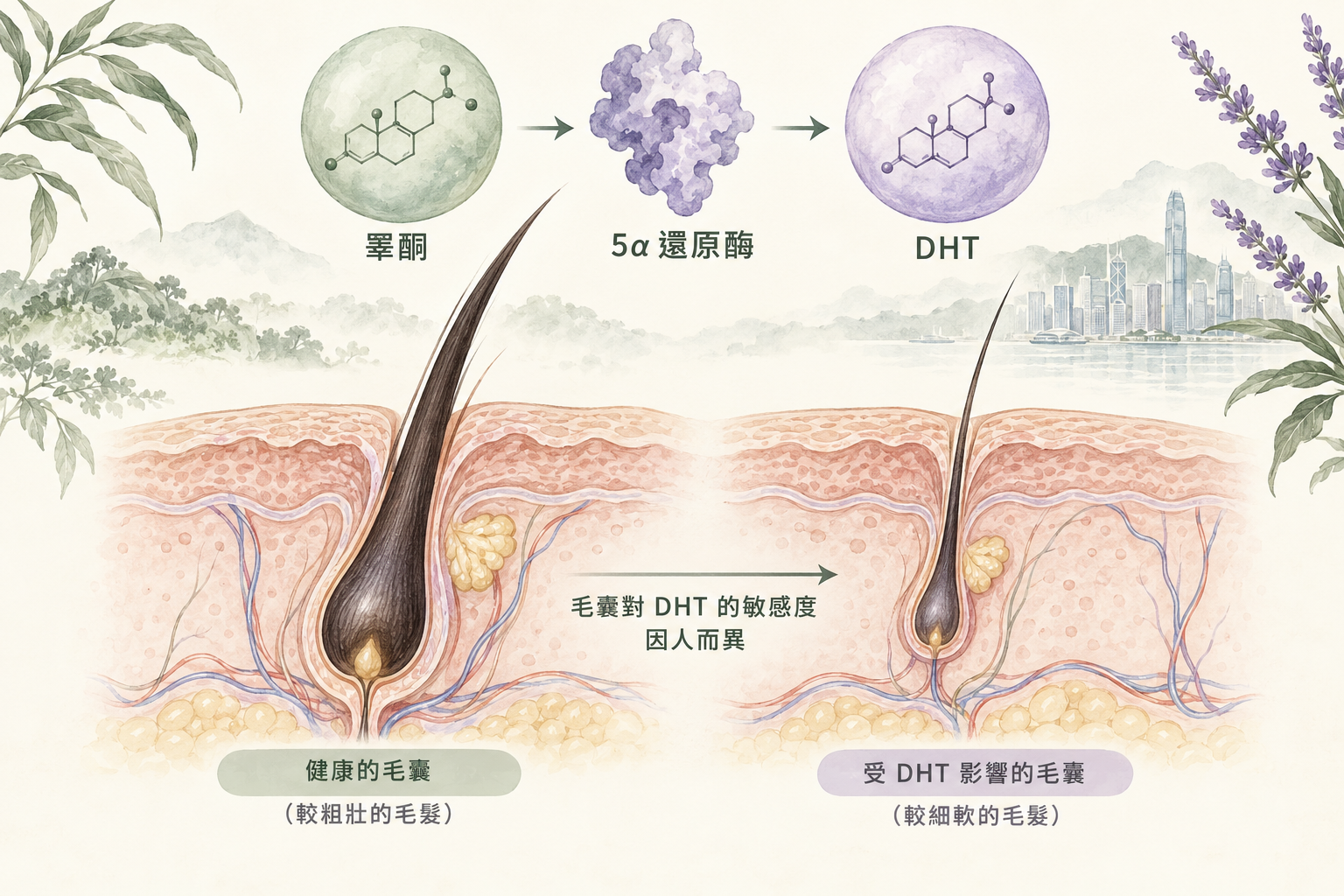 Illustration of DHT and hair loss